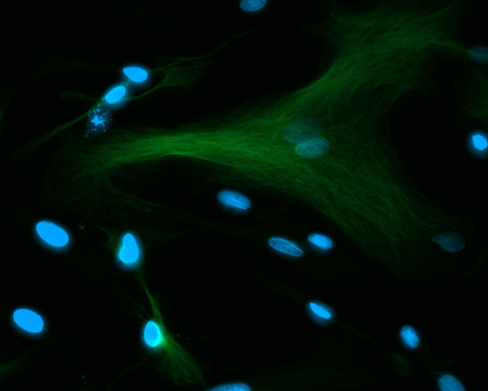 Micrografia de fluorescência de tecido neural da pesquisa olfativa